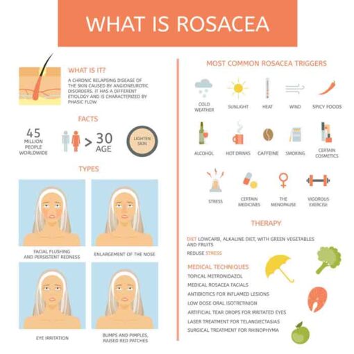 How To Calm Rosacea Flare Up A Complete Guide